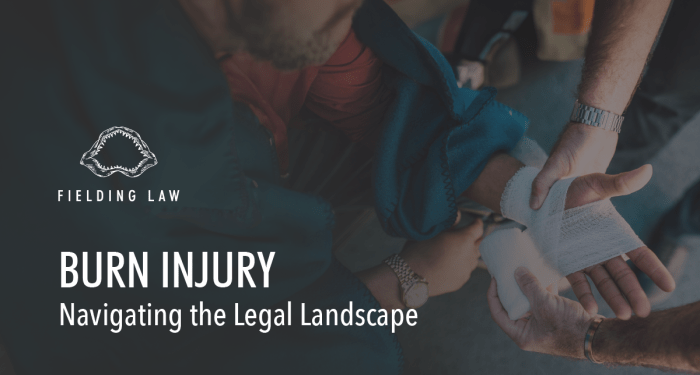 Burn Injury Lawyer | Fielding Law Firm, APC